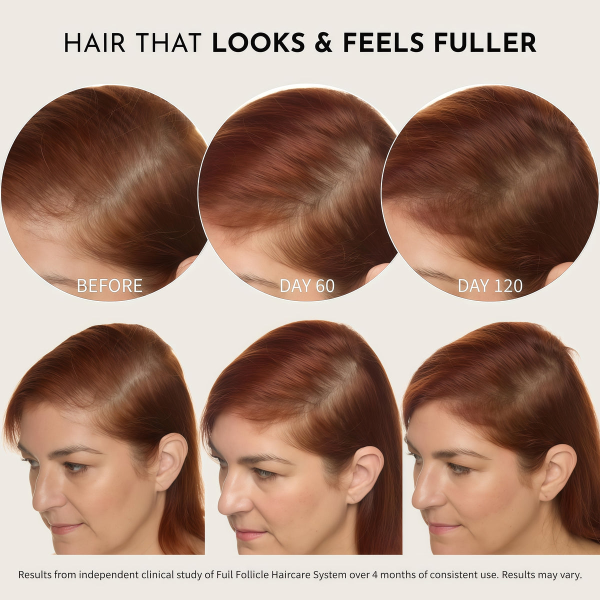 Full Follicle Advanced Scalp Serum